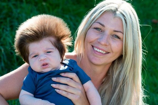 Απίστευτο: Γνωρίστε το μωρό-ευχούλης που είναι μόλις 2 μηνών! παράξενα μαλλιά 