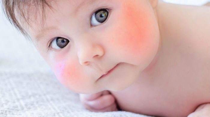 Τι σημαίνουν τα κόκκινα μαγουλα στο μωρό; κόκκινα μάγουλα 