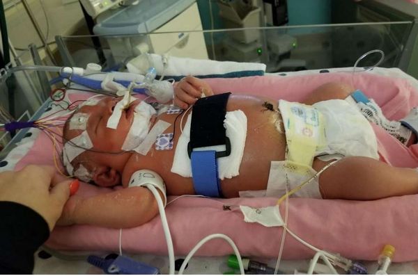 Απίστευτο: Θανατηφόρο φιλί σε νεογέννητο   Απίστευτο: Θανατηφόρο φιλί σε νεογέννητο μηνιγγίτιδα